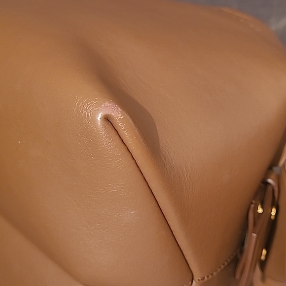 Acne Tan musubi. - Picture 13 of 14